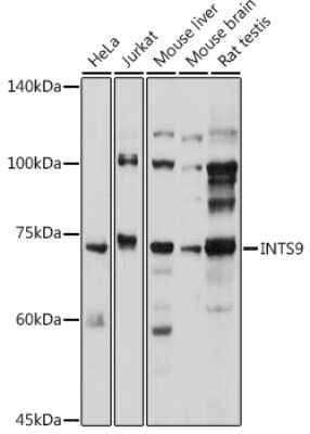 Western Blot: RC74 AntibodyBSA Free [NBP2-93568]